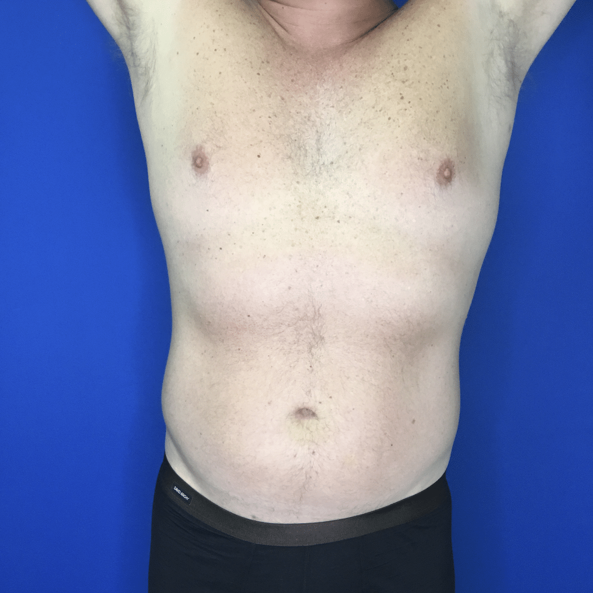 A Person Wearing A Blue Shirt